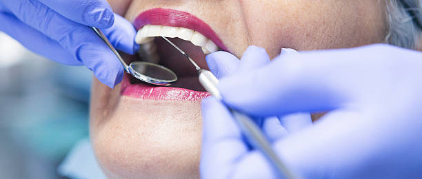 Best Emergency Root Canal Treatment in Winterville, NC